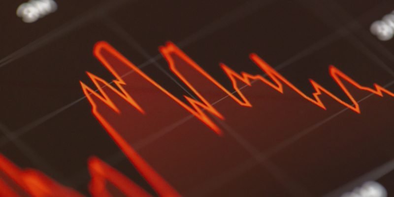 ServiceNow in Deep Waters as CEO Confirms Tech Firm Not Able to Compete with Strong Dollar